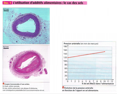 Doc_1_impacts_de_la_consommation_de_sel_sur_la_sante.PNG