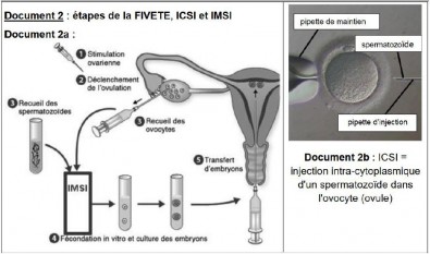 FIVETE_et_ICSI.JPG