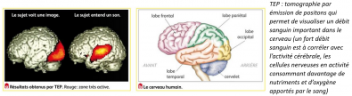 Le_cortex_occipital_traite_les_informations_visuelles.PNG