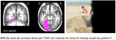 Resultats_cliniques.PNG