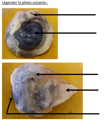 Structure_generale_de_l_oeil.PNG