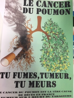 Cancer poumon.jpg